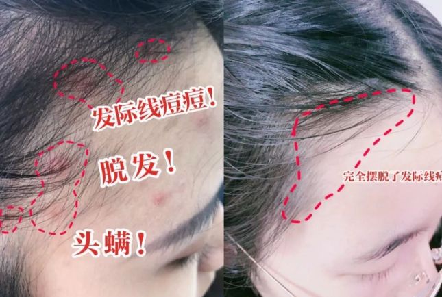 ?10分钟轻松养成女明星「绸缎发」澳门新葡京洗完头自然风干还是吹干好(图1) ?10分钟轻松养成女明星「绸缎发」澳门新葡京洗完头自然风干还是吹干好(图1)